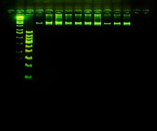 Agarose Gel Electrophoresis