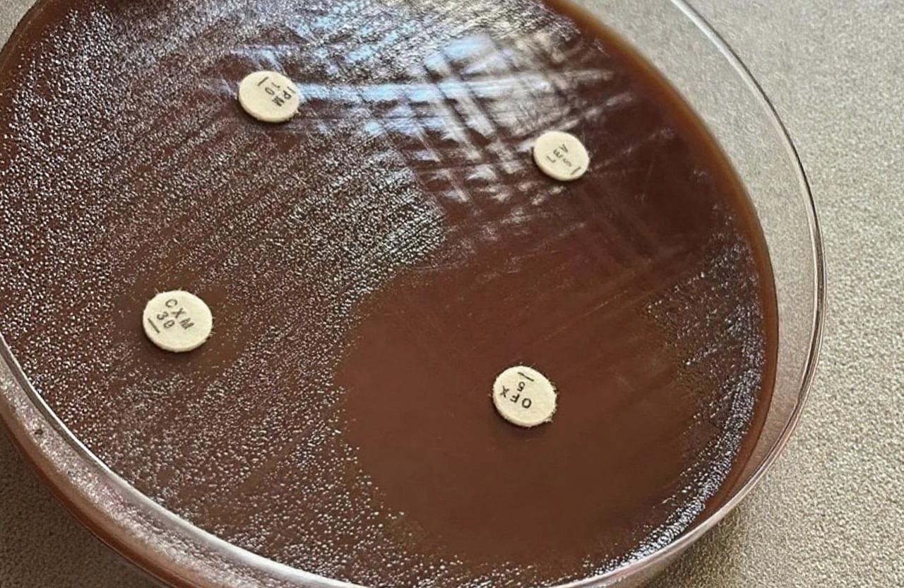 Antimicrobial Effectiveness Testing (AET)