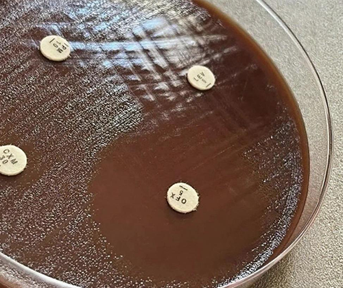 Antimicrobial Effectiveness Testing (AET)