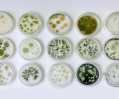 Microbial Identification