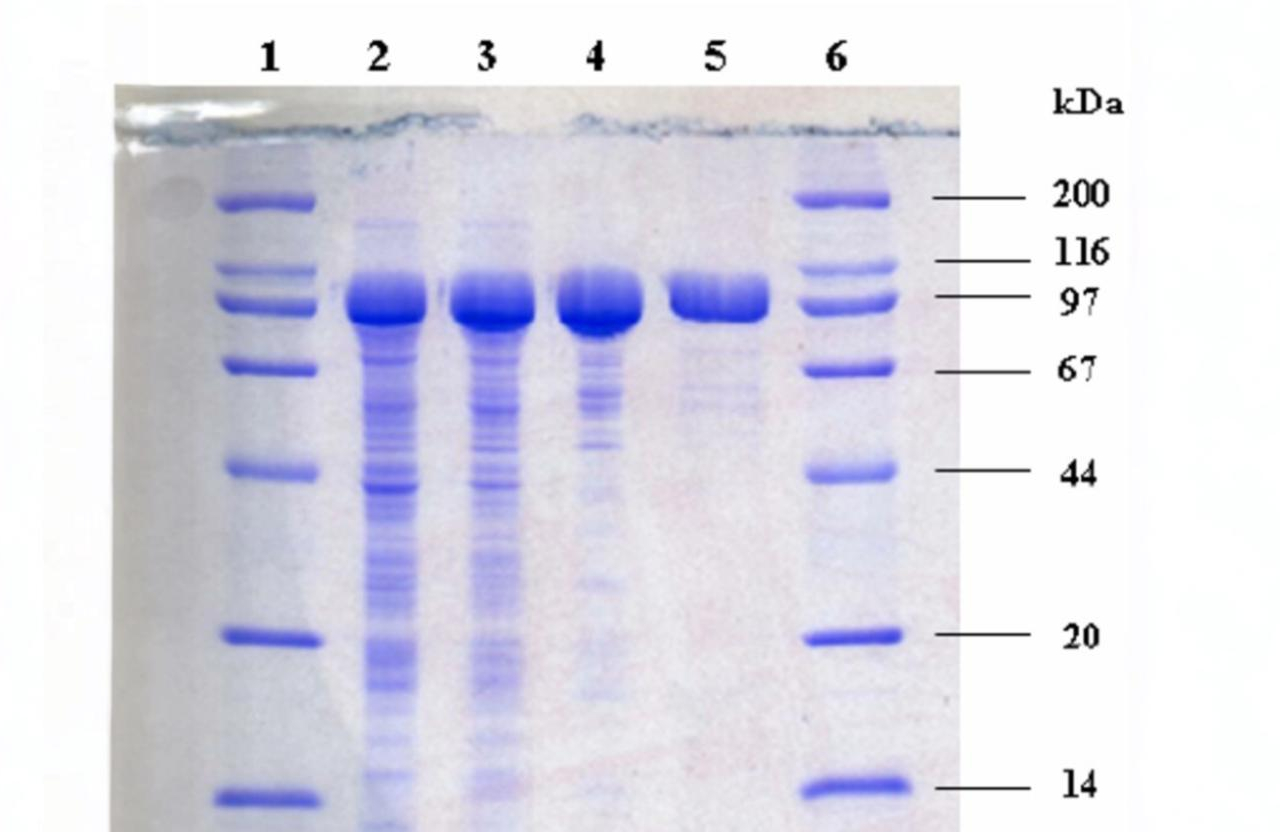 Polyacrylamide Gel Electrophoresis (PAGE)