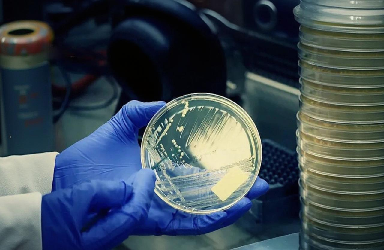 The Microbial Enumeration Test