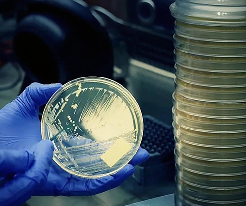 The Microbial Enumeration Test