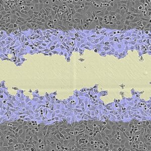 Scratch Assay (Cell Migration Assay)