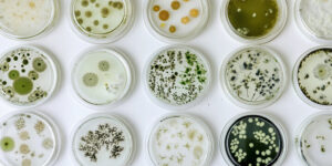 Microbial Identification
