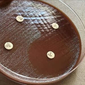 Antimicrobial Effectiveness Testing (AET)